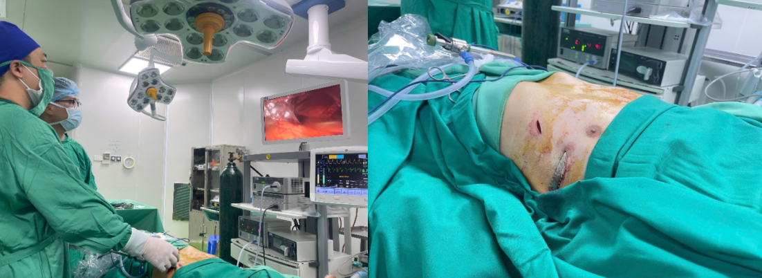 LÕM NGỰC BẨM SINH Ở TRẺ: PHÁT HIỆN SỚM, ĐIỀU TRỊ ĐÚNG THỜI ĐIỂM